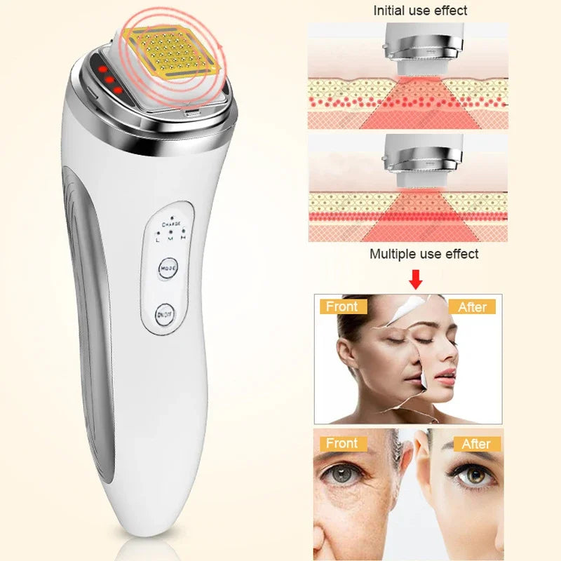 Face Lifting  Home Wrinkle Remover Skin Tightening Facial Massage Machine